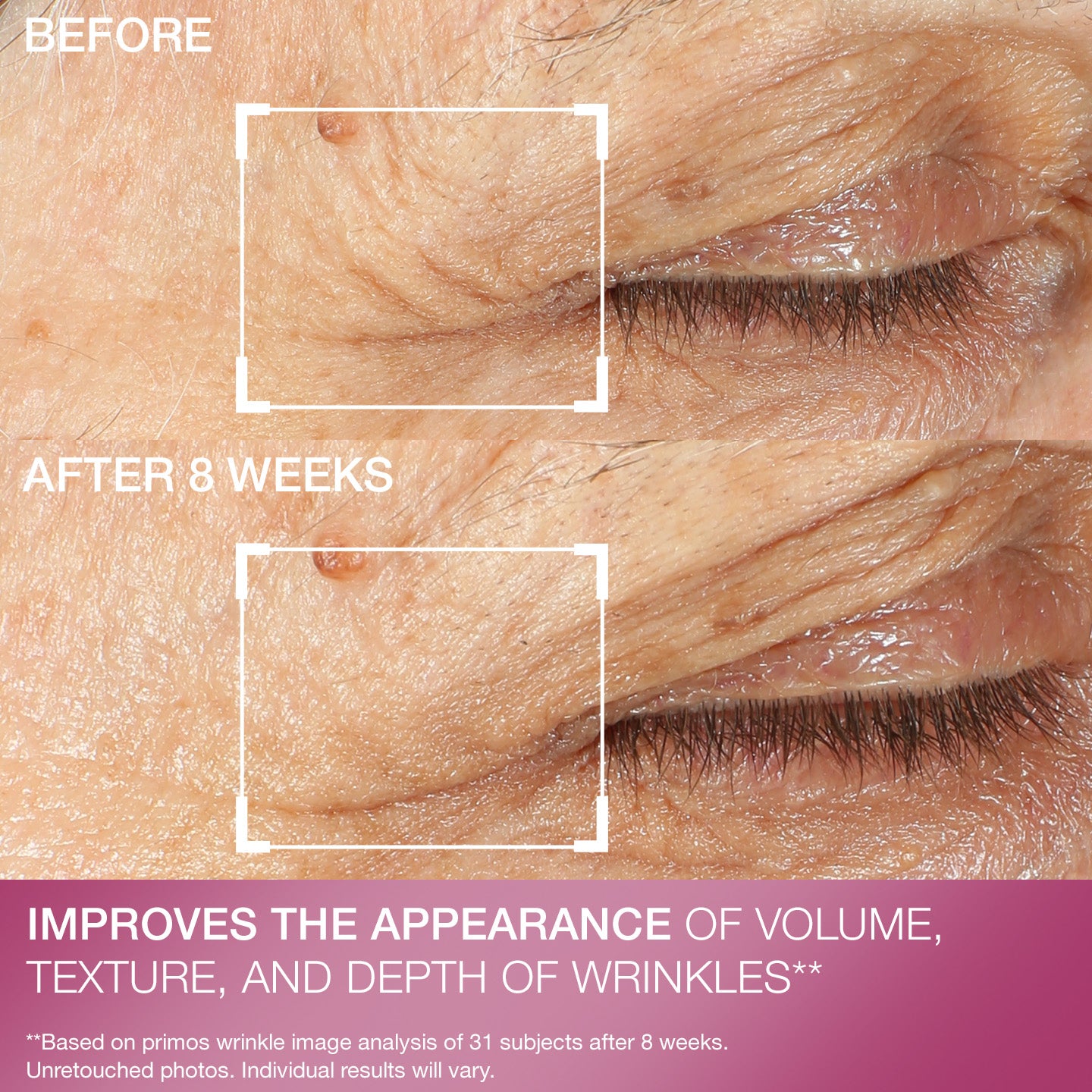 Advanced Retinol Multi-Correct Eye Cream - Image 9