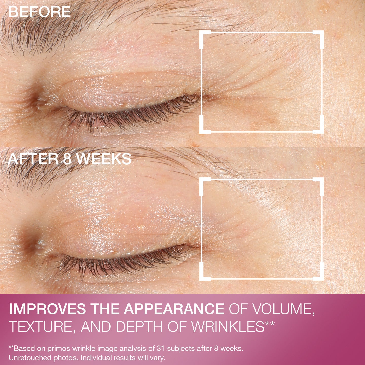 Advanced Retinol Multi-Correct Eye Cream - Image 10