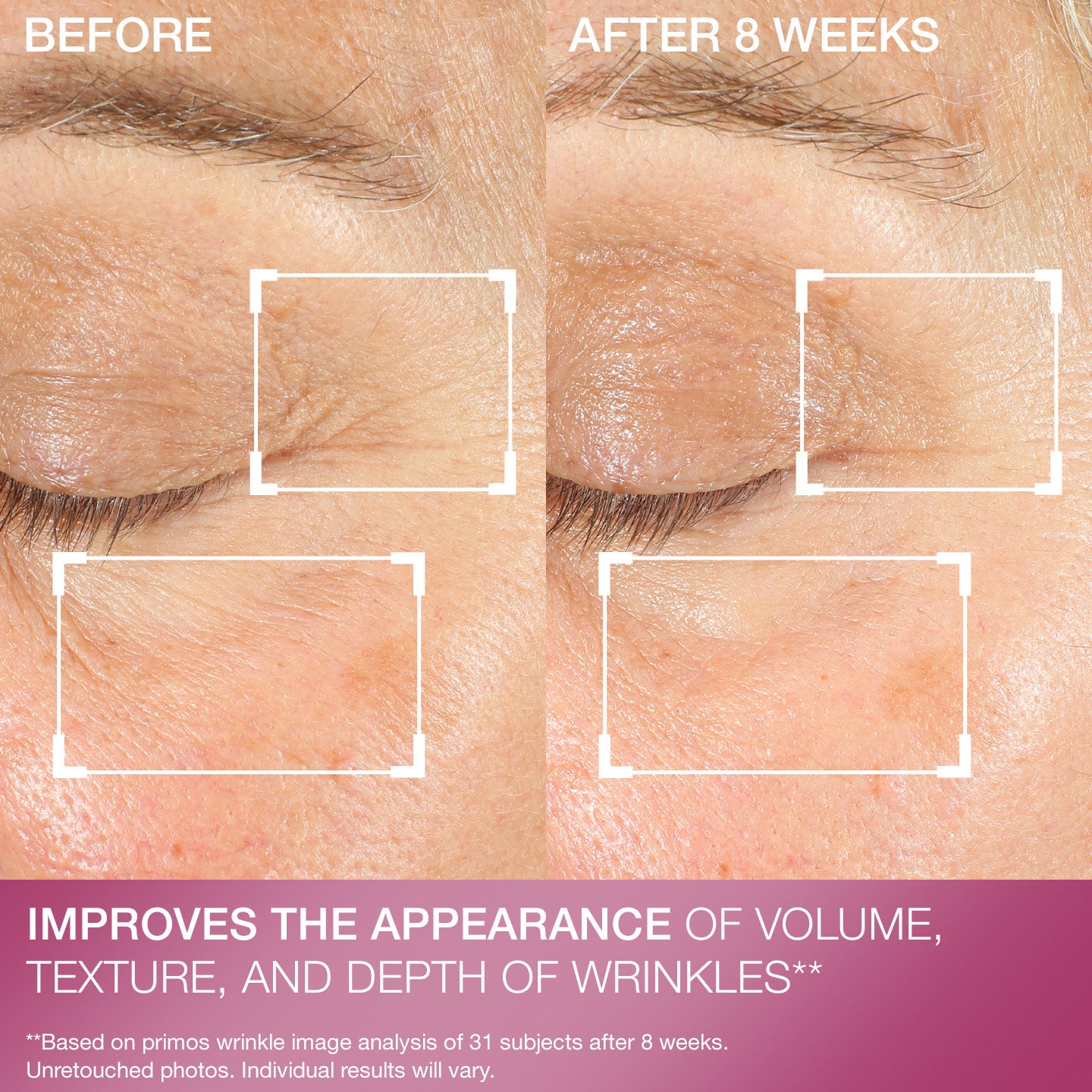 Advanced Retinol Multi-Correct Eye Cream - Image 11