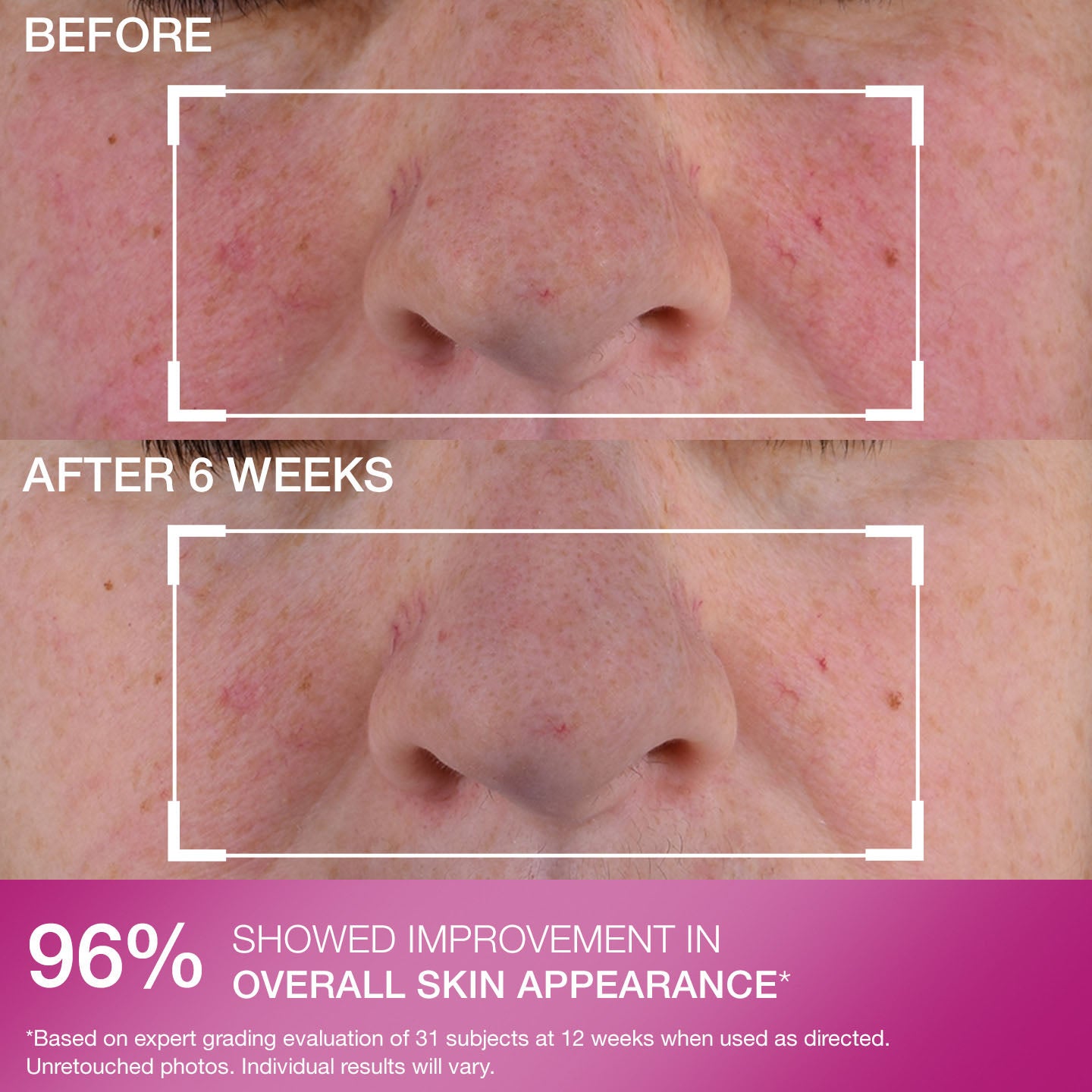 Advanced Retinol Nightly Multi-Correct Serum - Image 6