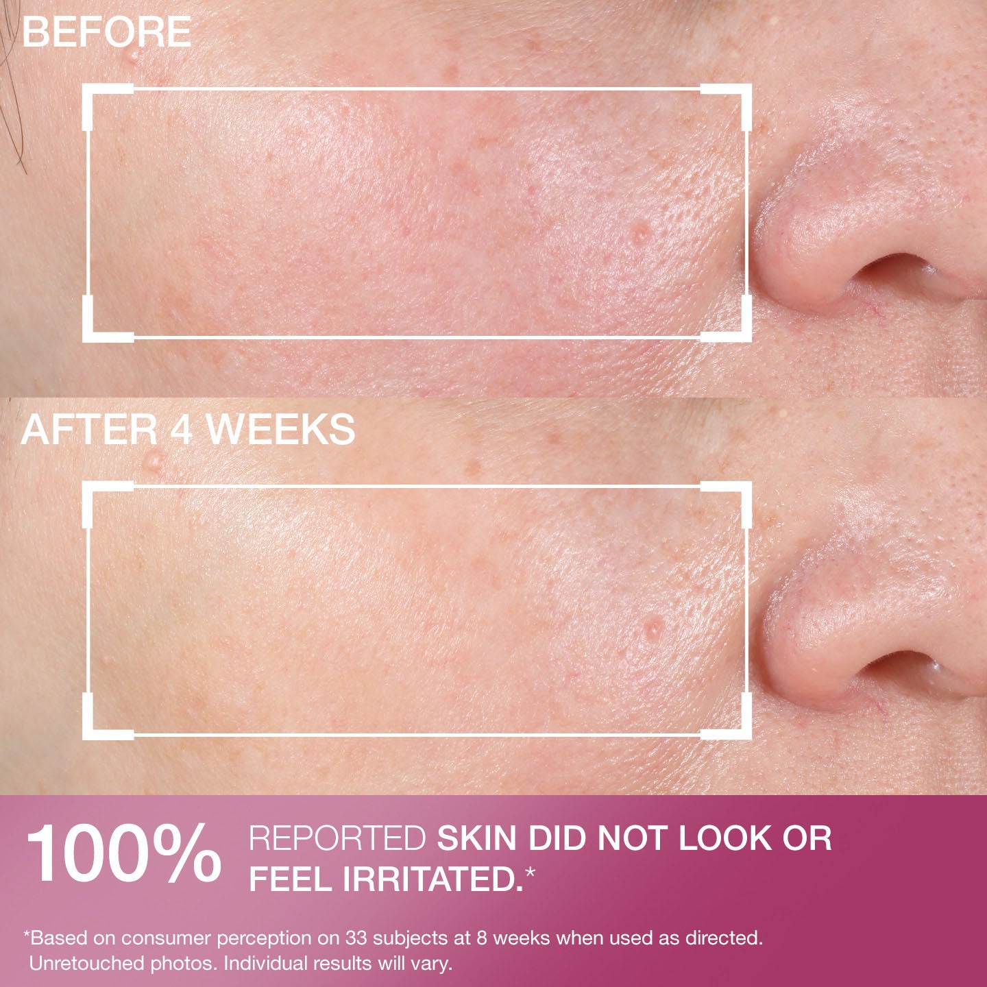Advanced Retinol Nightly Renewal Moisturizer - Image 8