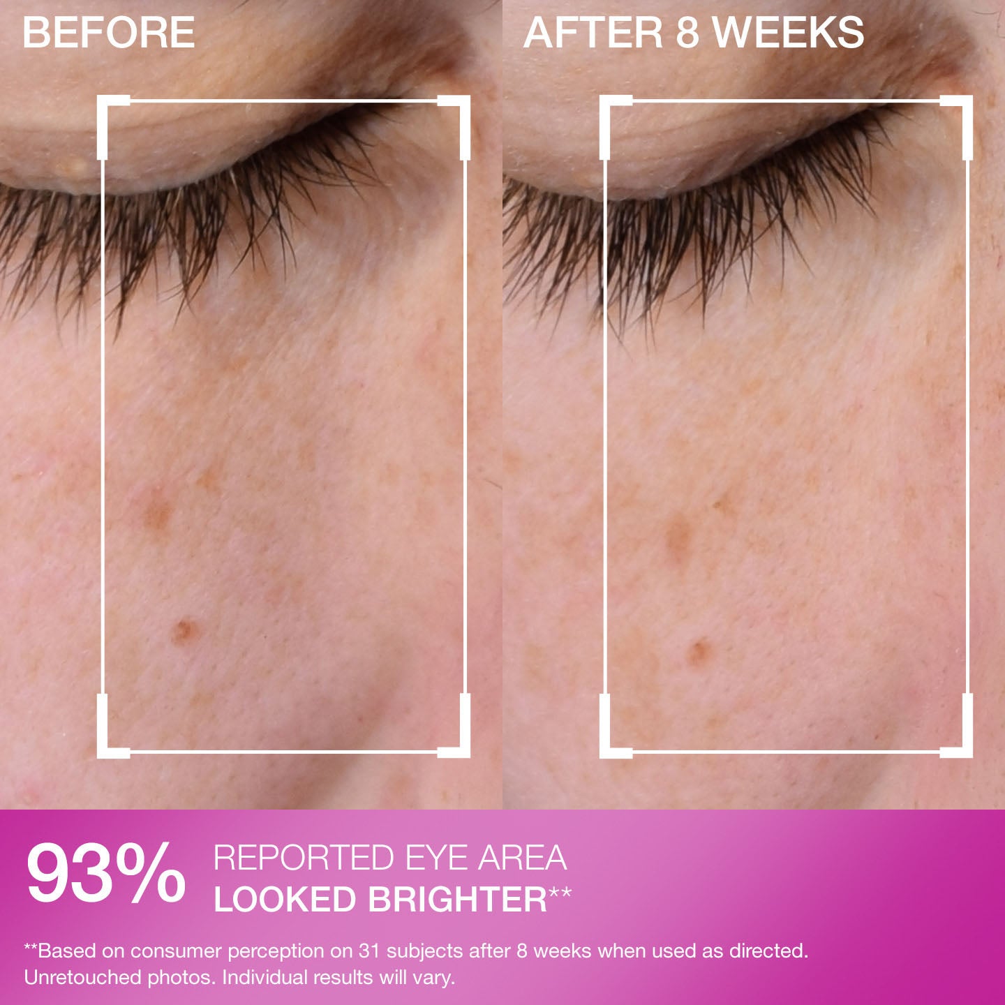 Super-C Dark Circle Brightening Eye Serum - Image 9