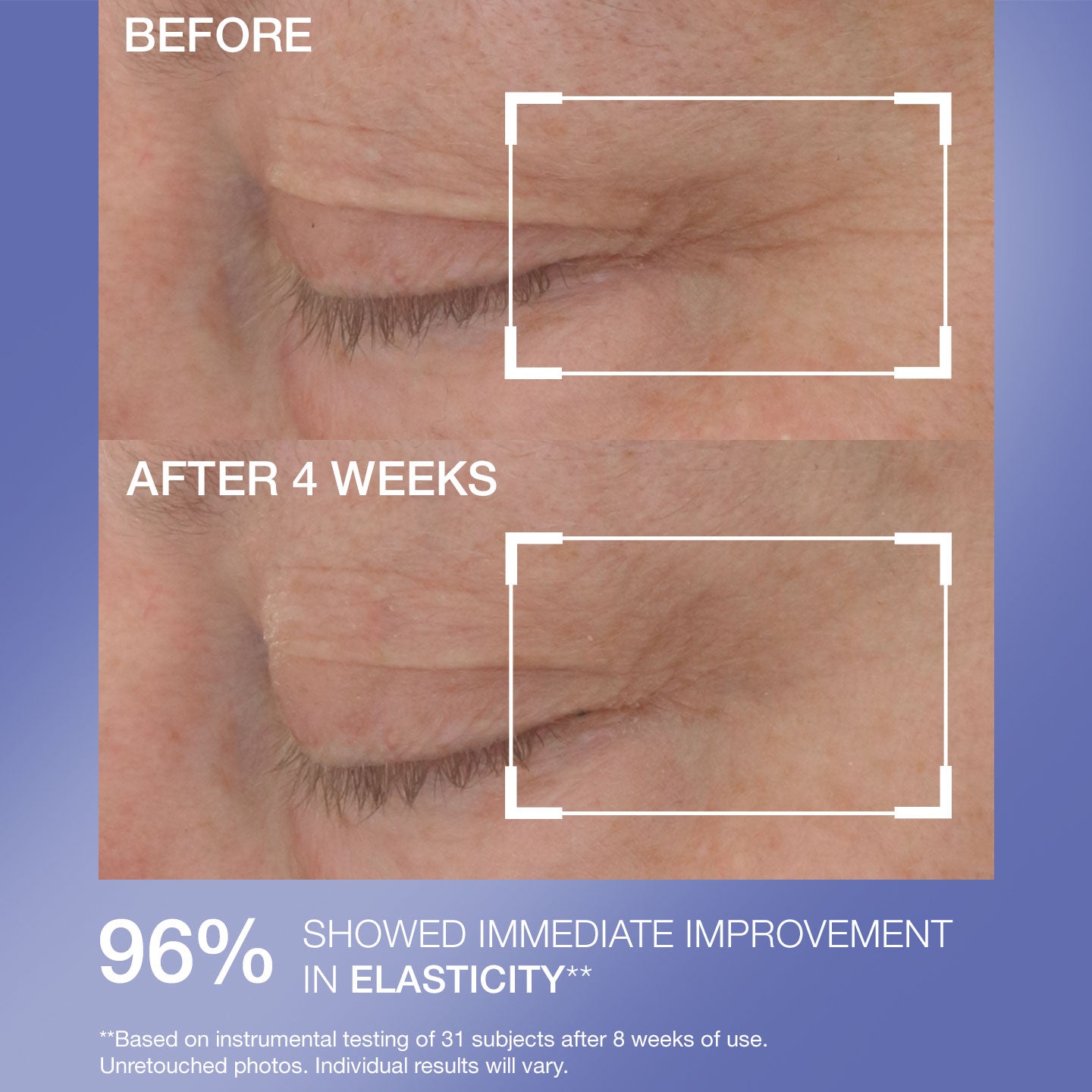 Hyaluronic Tripeptide Gel-Cream for Eyes - Image 7