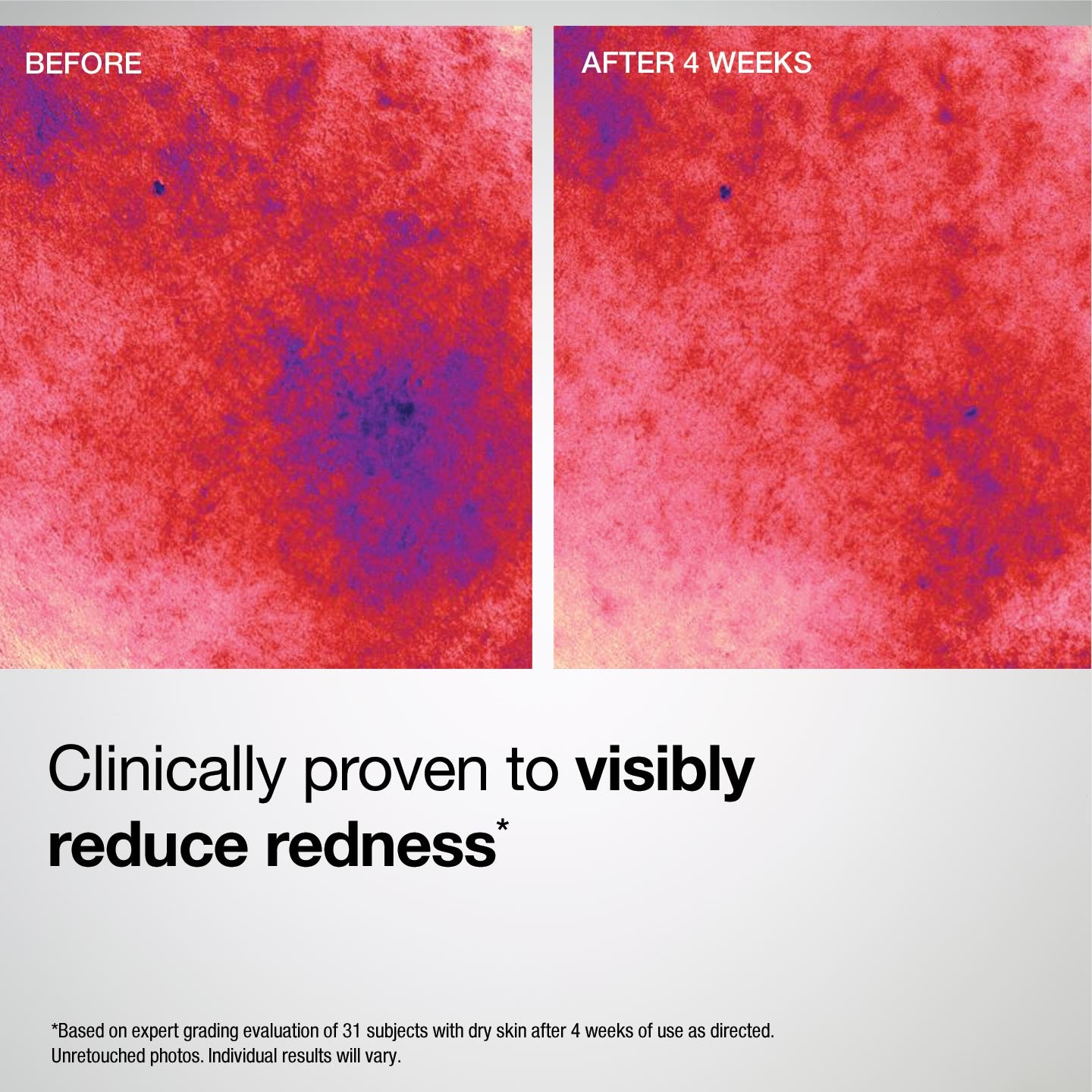 Barrier Restore+ Soothing Ceramide Cream - Image 6