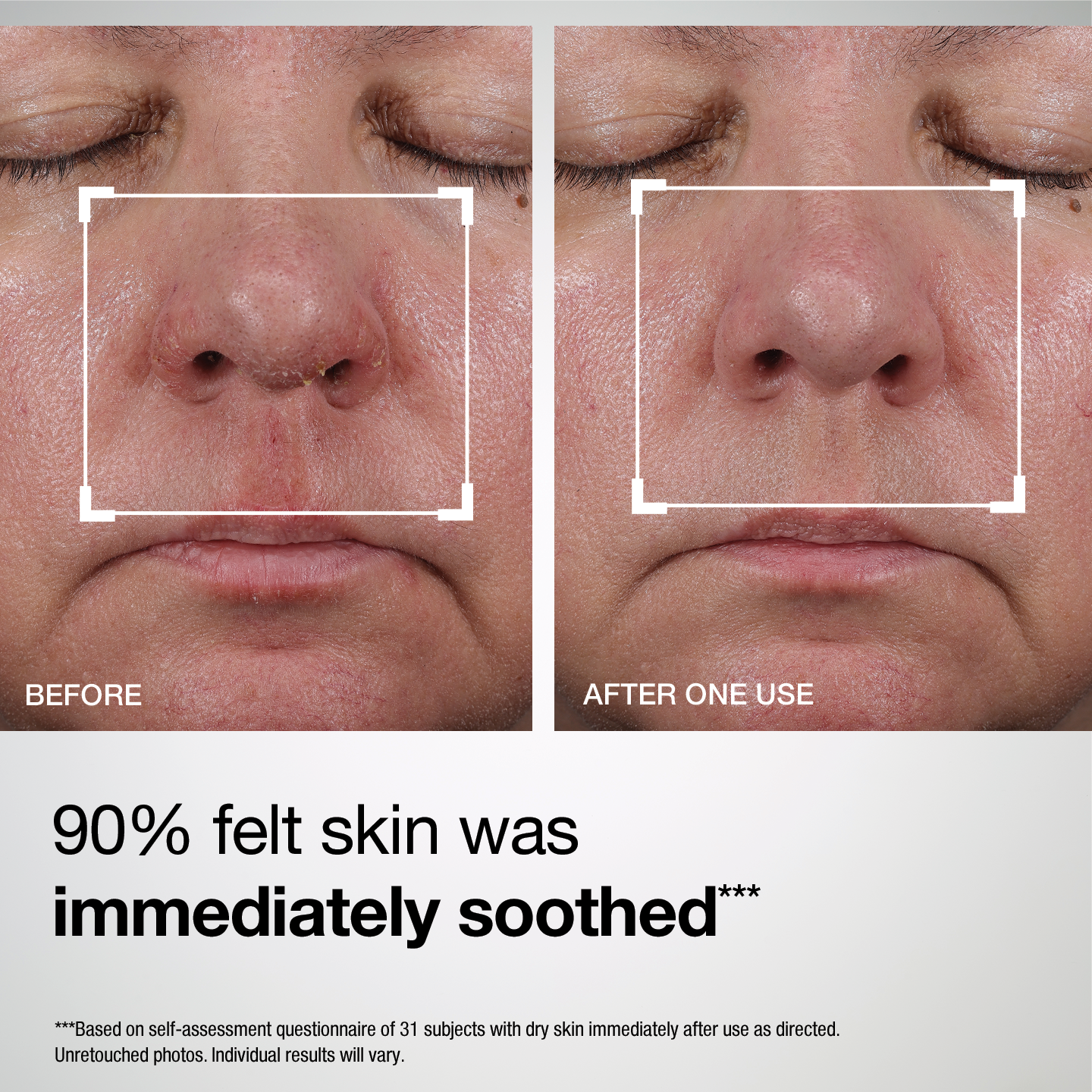 Barrier Restore+ Soothing Ceramide Cream - Image 8