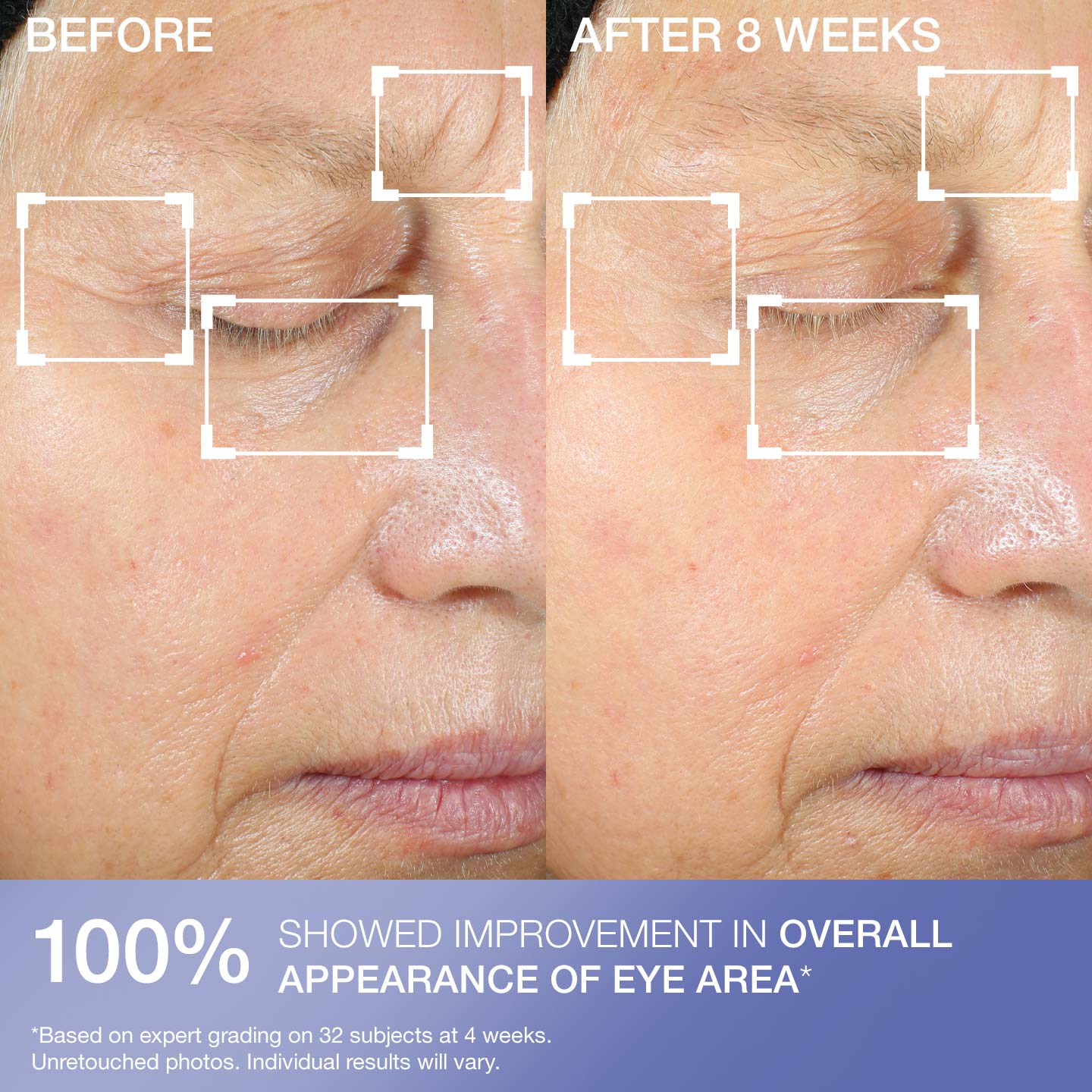 Intensive Eye Concentrate for Wrinkles PLUS - Image 6
