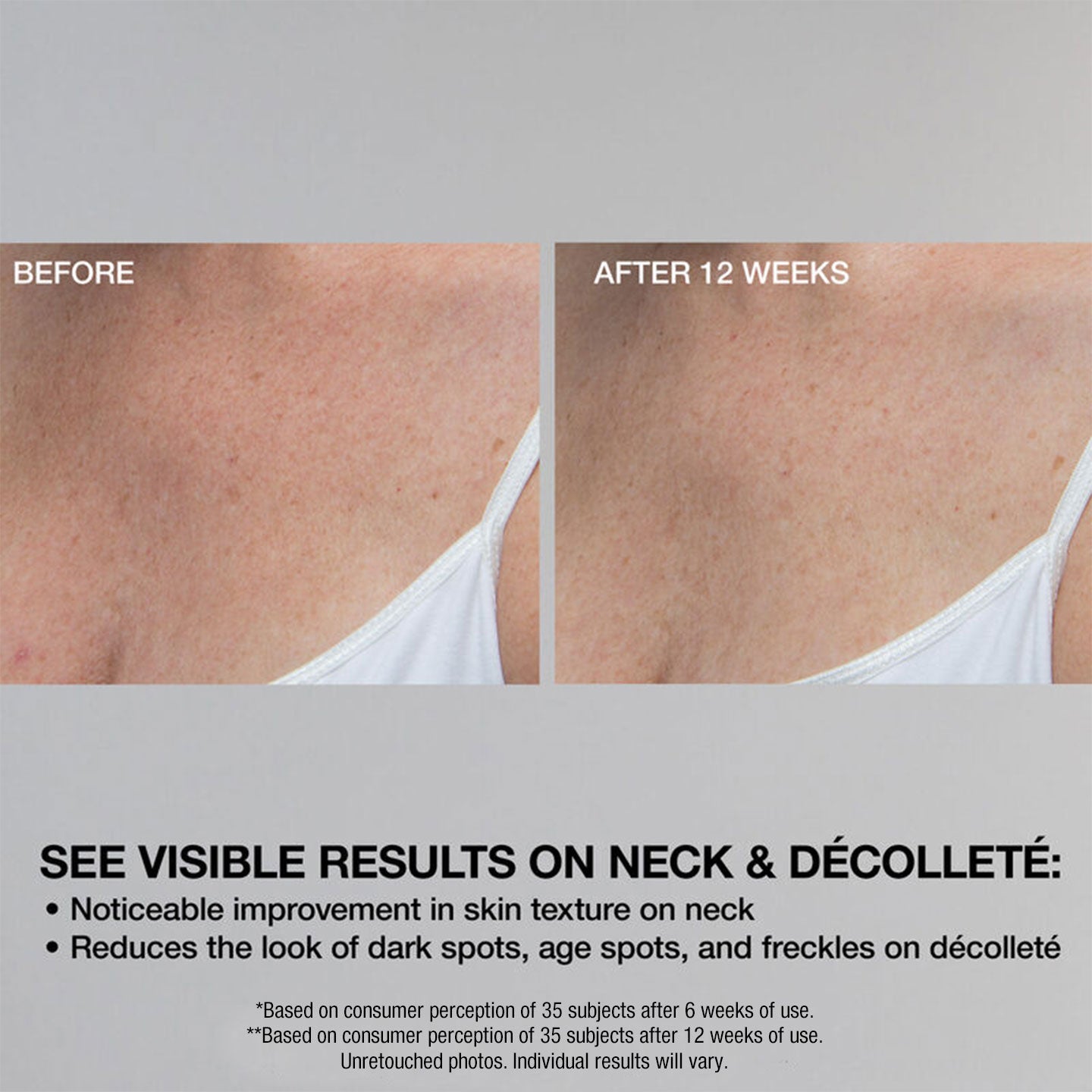 Super-C Retinol Brighten Correct Vitamin C Serum - Image 4