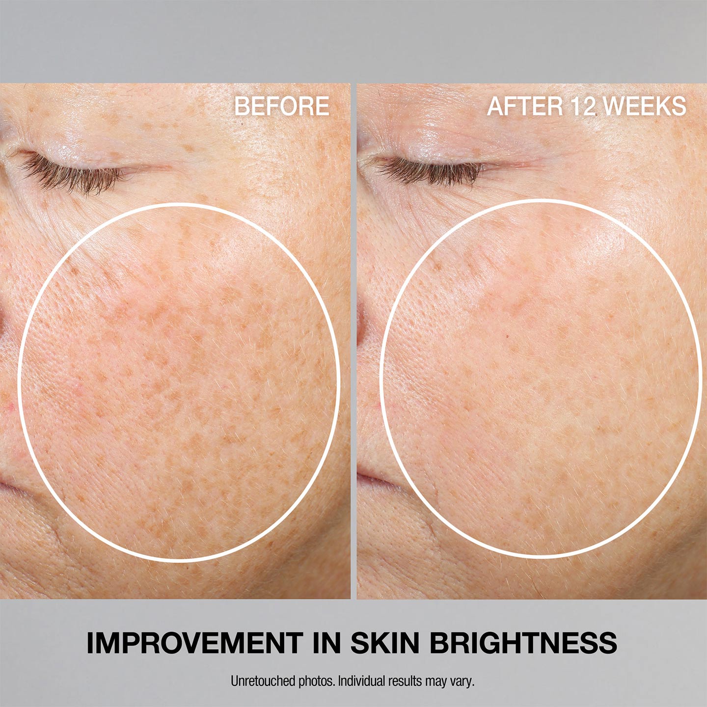 Super-C Retinol Brighten Correct Vitamin C Serum - Image 8