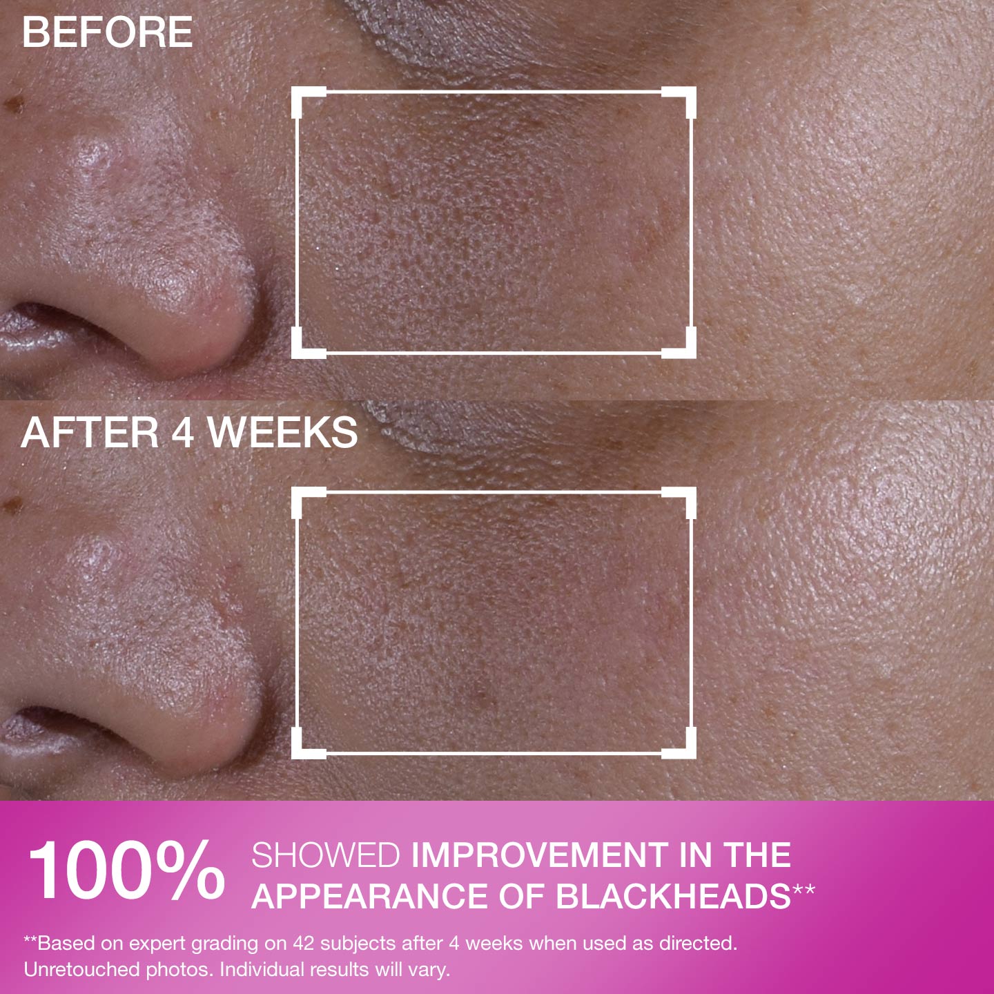 Super Shrink Pore Minimizing Serum - Image 7