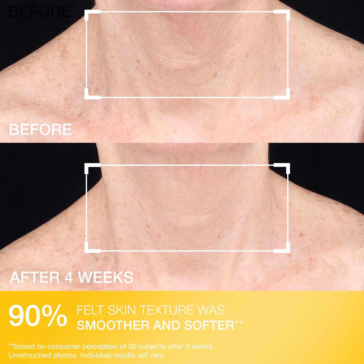 TL Advanced  Tightening Neck Cream Light - Image 5