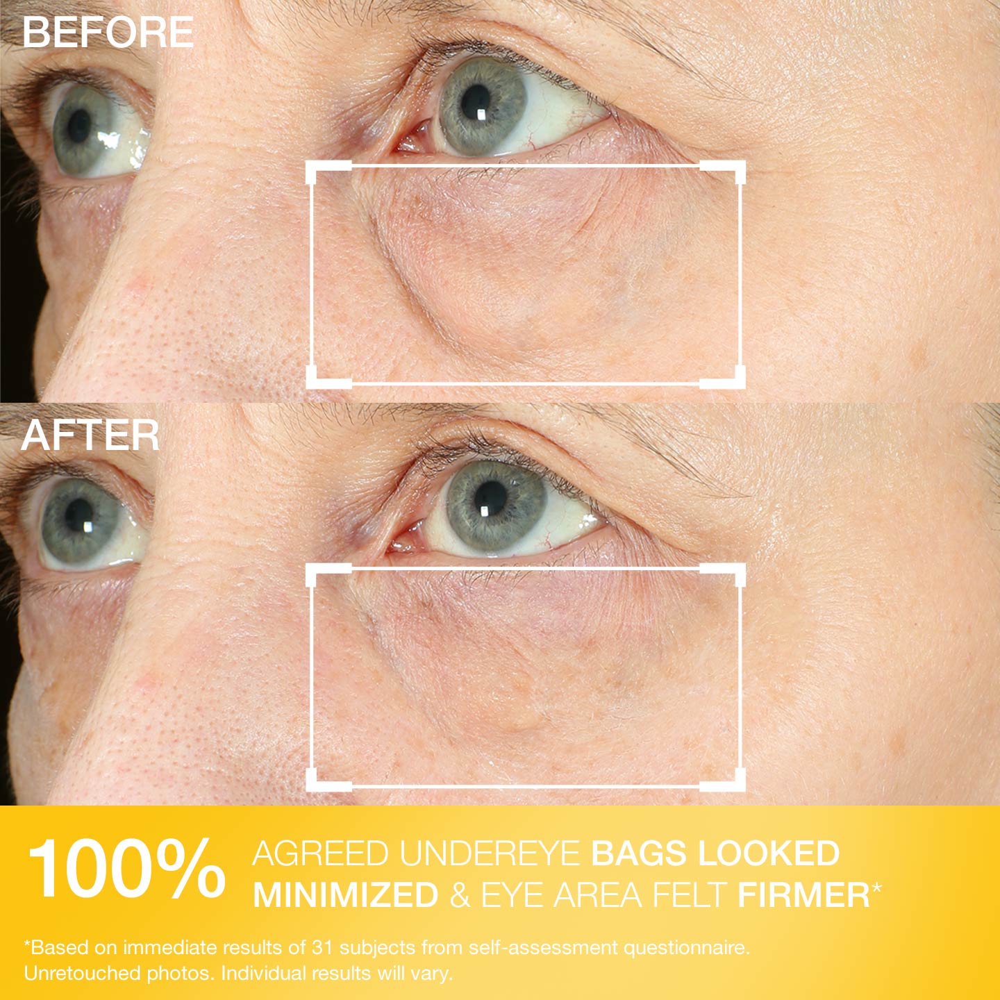 Hyperlift Eye® Instant Eye Fix - Image 6