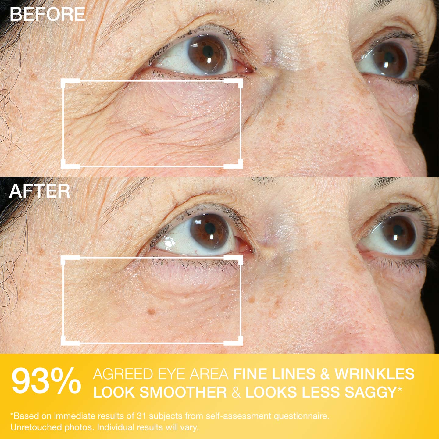 Hyperlift Eye® Instant Eye Fix - Image 7