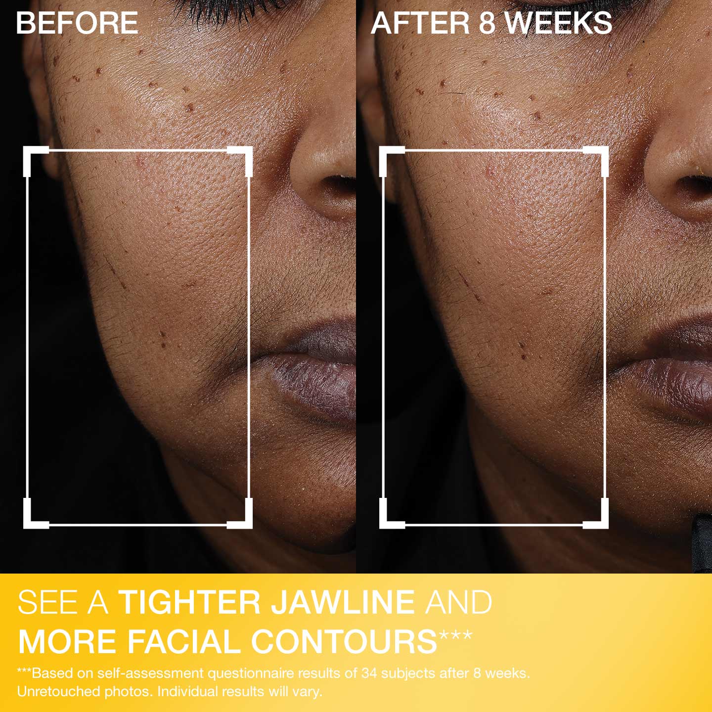 Peptight  Face Lift Serum - Image 6