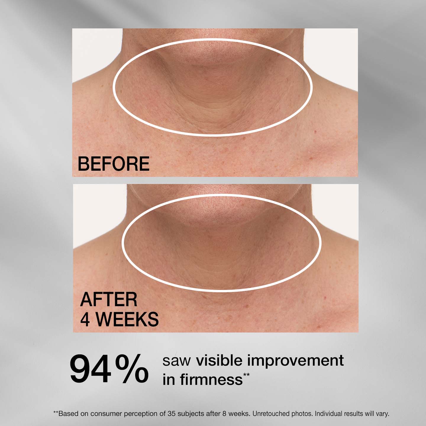 TL Advanced  Tightening Neck Cream PLUS - Image 6