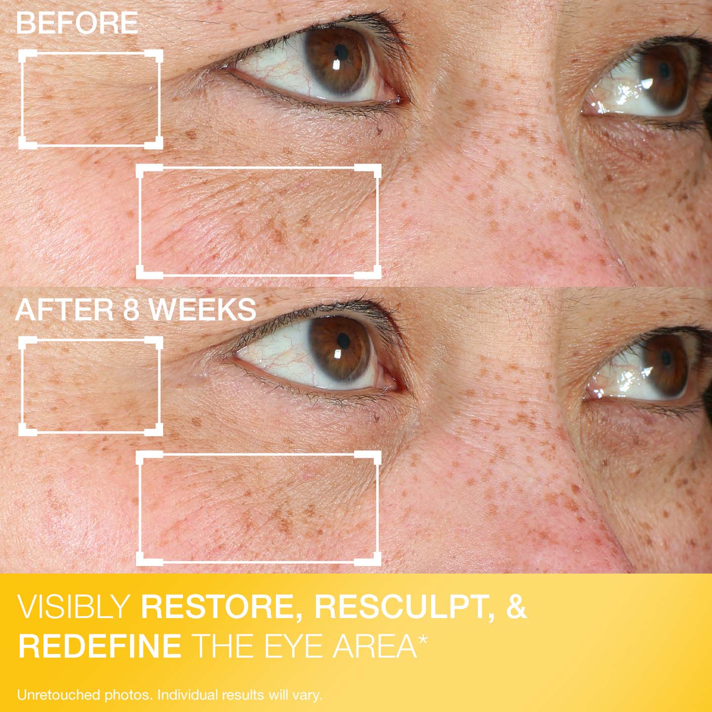 Contour Restore® Firming Moisture Balm for Eyes - Image 7
