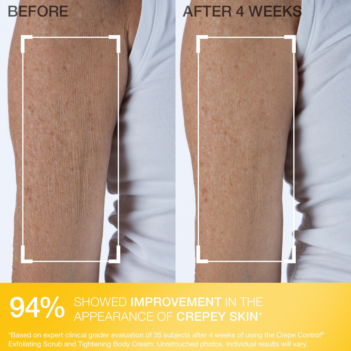 Crepe Control Tightening Body Cream - Image 5