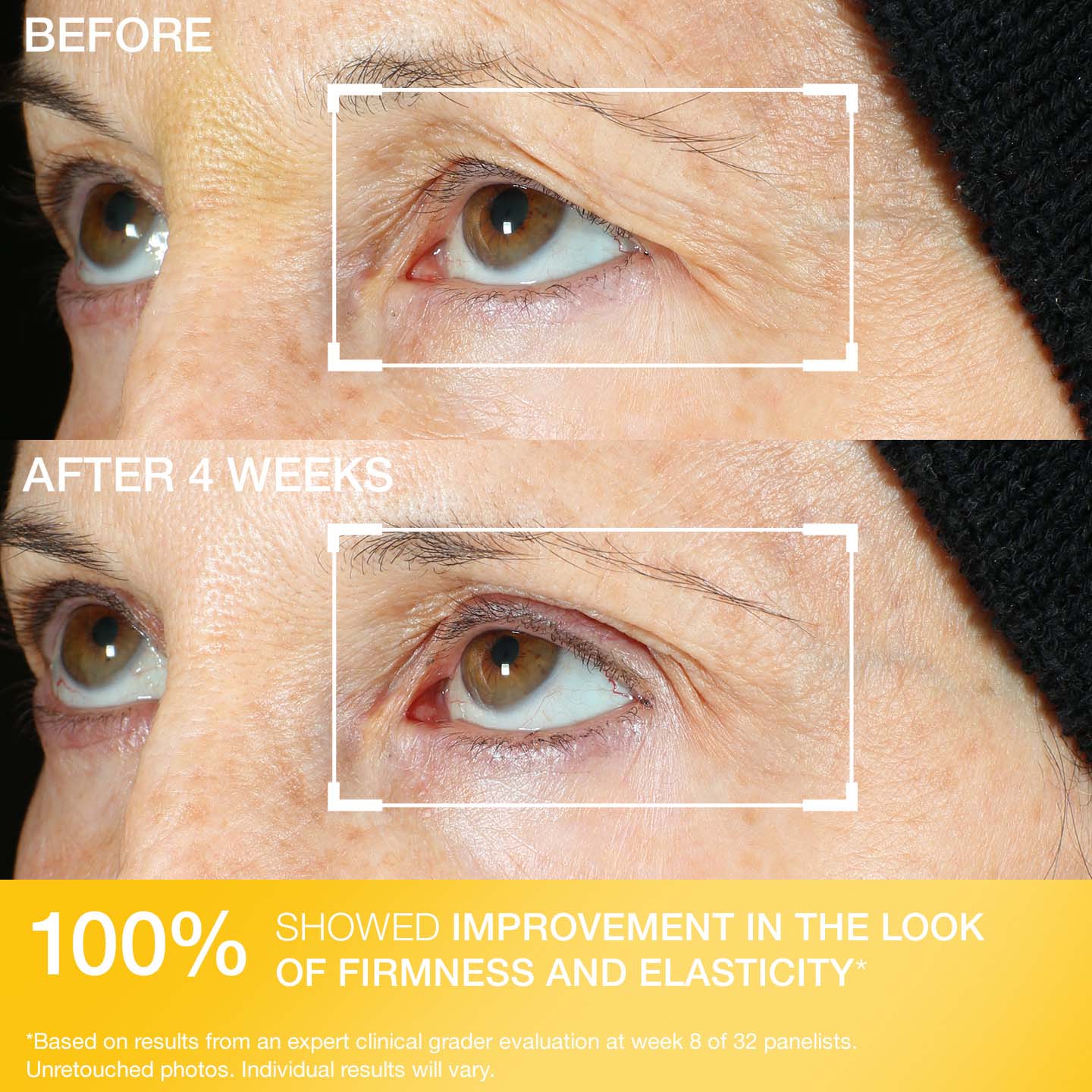 Peptight® 360˚ Tightening Eye Serum - Image 8