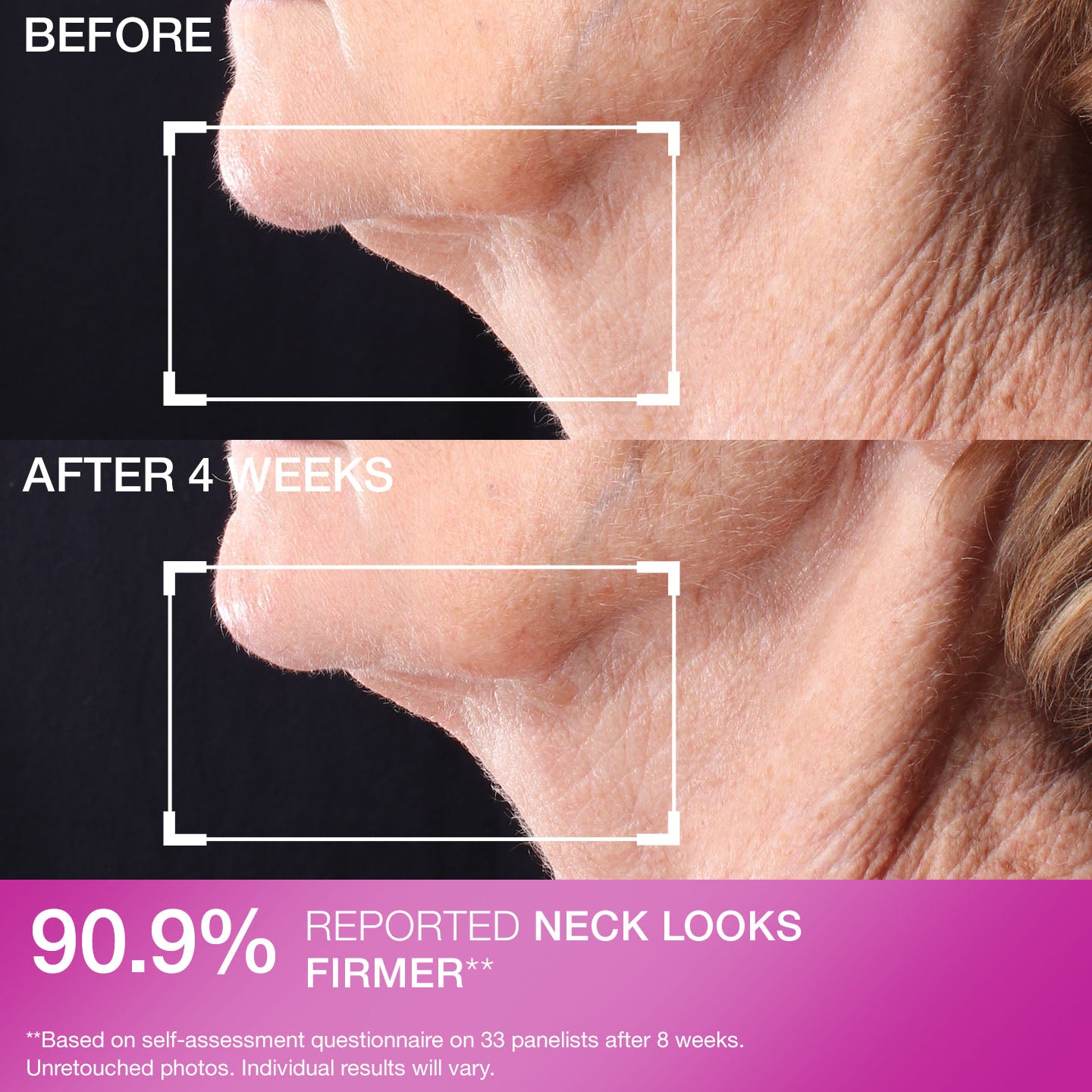 Peptight  Tightening Neck Serum Roller - Image 5